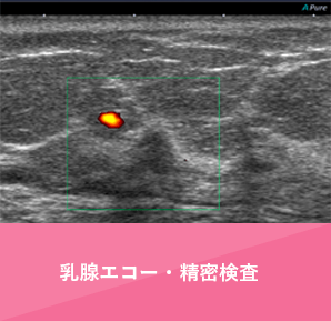 乳腺エコー・精密検査